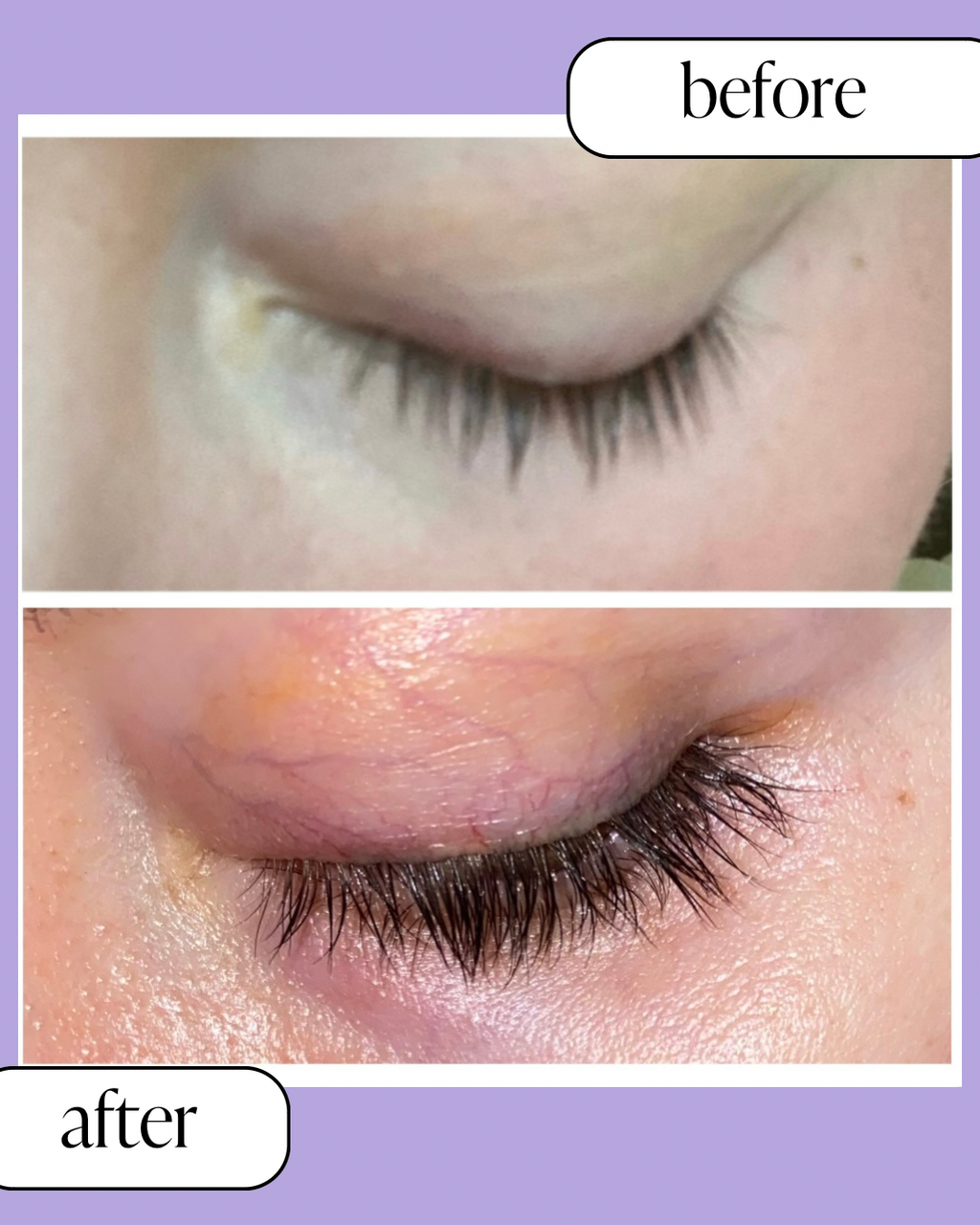 Siren Eyelash Growth Serum