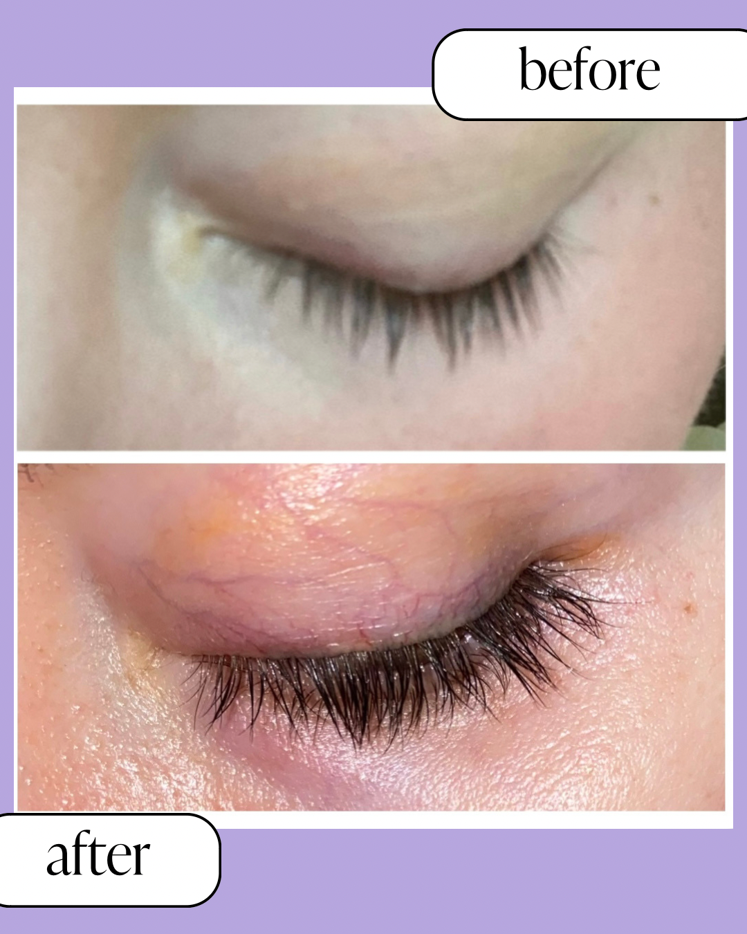 Siren Eyelash Growth Serum