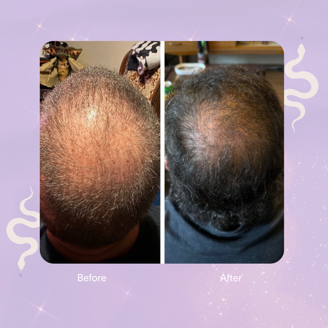 Strengthen Scalp & Hair Treatment Oil