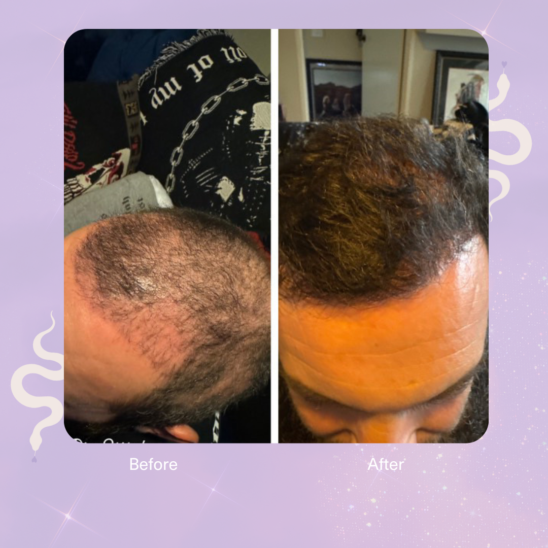 Strengthen Scalp & Hair Treatment Oil