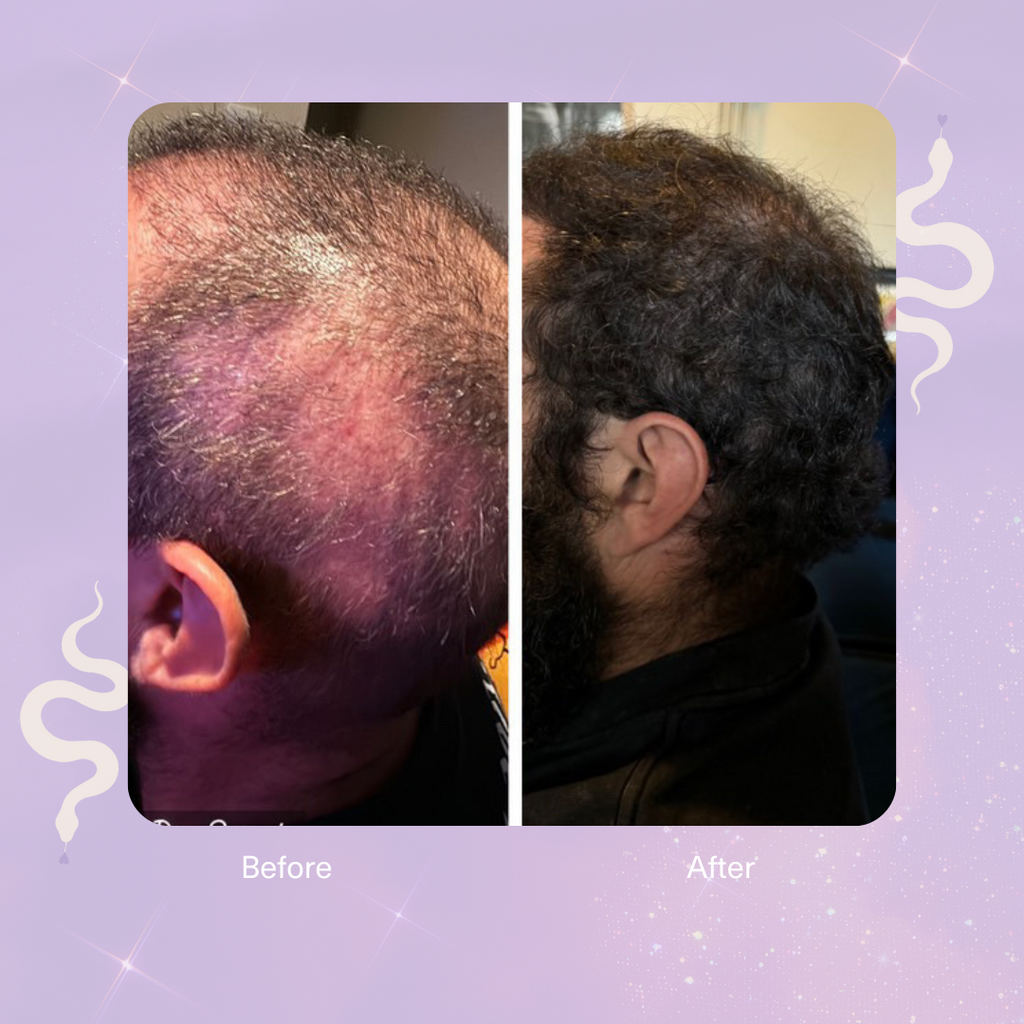 Strengthen Scalp & Hair Treatment Oil