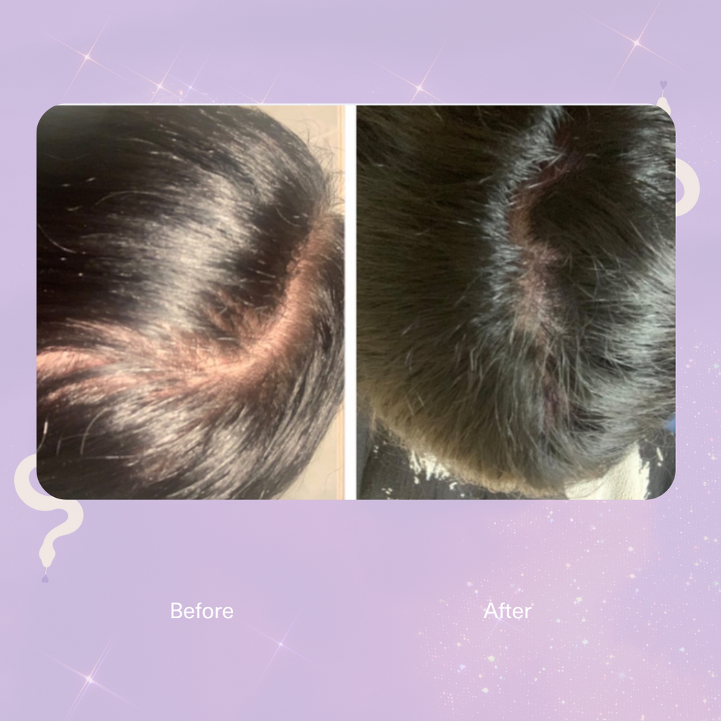 Strengthen Scalp & Hair Treatment Oil