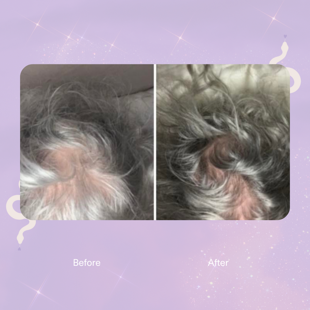 Strengthen Scalp & Hair Treatment Oil