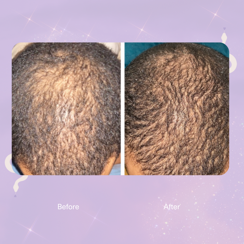 Strengthen Scalp & Hair Treatment Oil